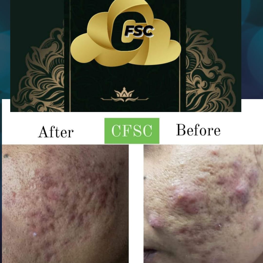 Before After Hair Treatment